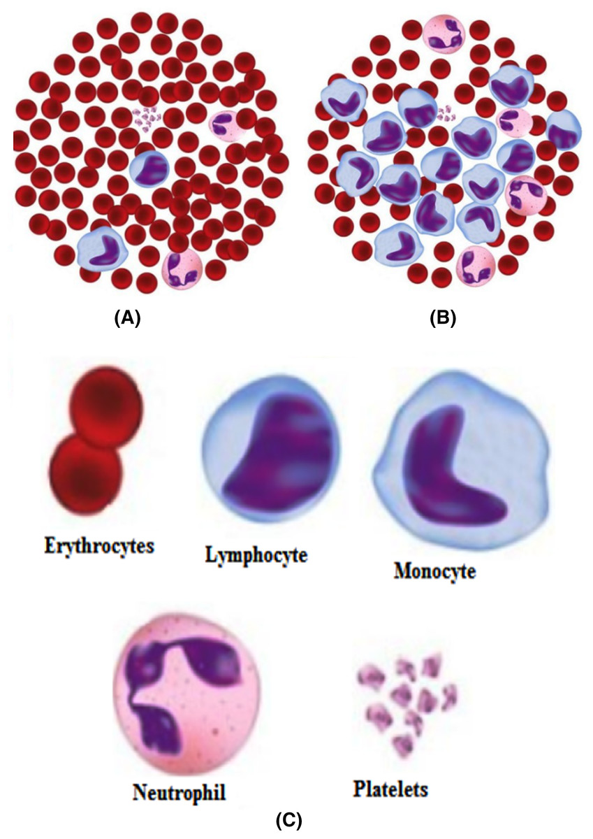 pot Contemporary Excrement A review of microscopic analysis of blood cells for disease detection with  AI perspective [PeerJ]