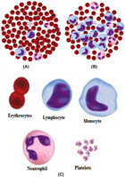 A review of microscopic analysis of blood cells for disease detection ...