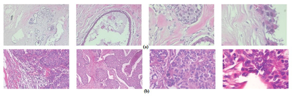 Samples of BreakHis dataset images with a 400× amplification factor: (A) malignant images, (B) benign images.