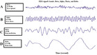 A novel multi-class imbalanced EEG signals classification based on the ...