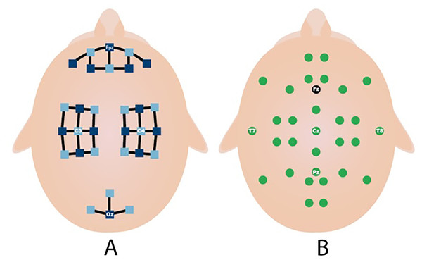 Electrodes placement (A) fNIRS sources (dark blue) and detector (light blue) channels. (B) EEG electrodes and ground (black) (Shin et al., 2017).