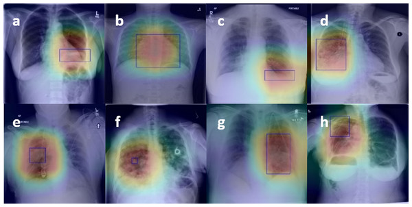 Figure 4. The results of the localization of chest diseases.