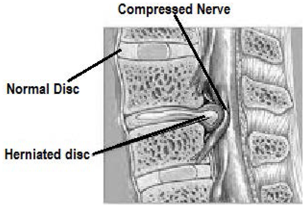 Diagnosis of vertebral column pathologies using concatenated resampling