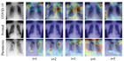 ECOVNet: A Highly Effective Ensemble Based Deep Learning Model For ...