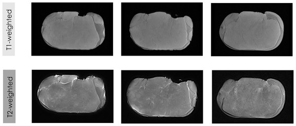 Some examples of LF-MRI images of pork loins.