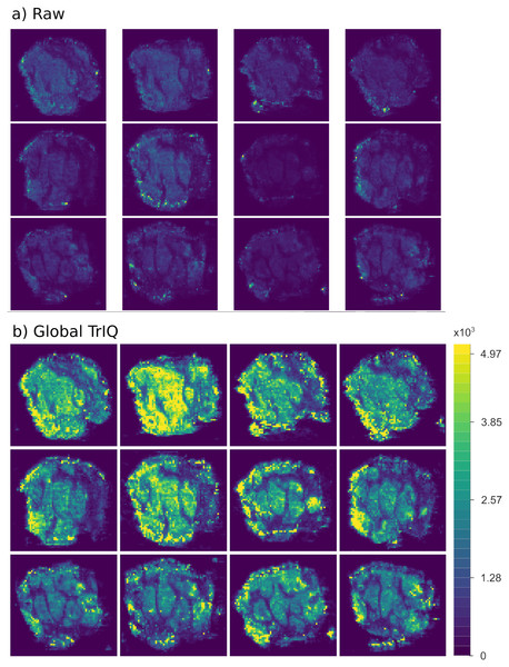 Global TrIQ applied to the ion 885.55 m/z of human colorectal adenocarcinoma DESI MSI slices, with P = 0.91 and 32 gray levels.