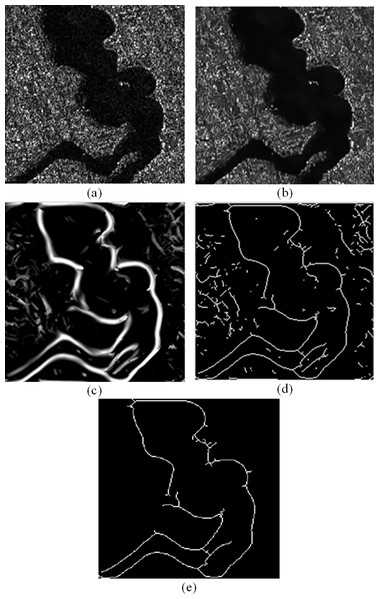 The detection results of the proposed method: (A) original image (B) non-local mean filtering preprocessing result (C) shearlet detection result (D) binarization and refinement result (E) final result.