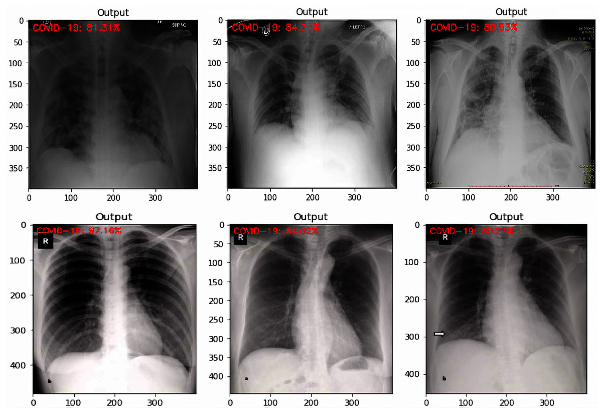 Modeling a deep transfer learning framework for the classification of ...