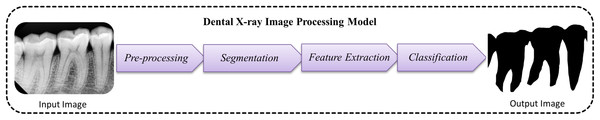Traditional model used for dental image segmentation and classification.