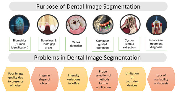 Purpose of segmentation & problems in dental imaging.