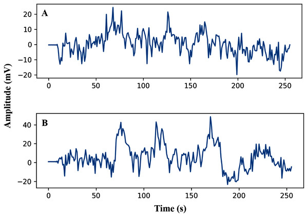 AEP raw data plotting in 2s decision window: (A) hear auditory stimulus with the left ear (B) hear auditory stimulus with the right ear.