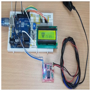 A new smart healthcare framework for real-time heart disease detection ...