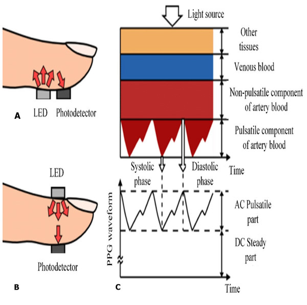 5-s representation of an electrocardiogram of a patient from the training data.