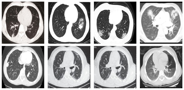 Sample CT images from the COVID19-CT dataset.