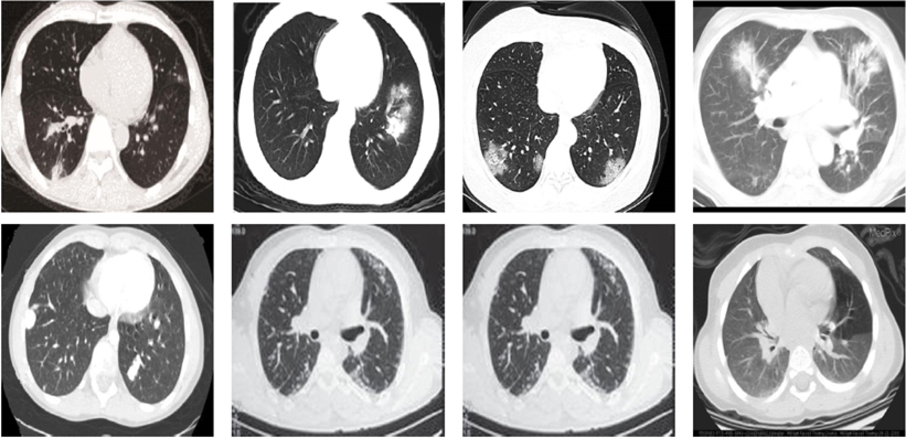 COVID-Nets: deep CNN architectures for detecting COVID-19 using chest ...