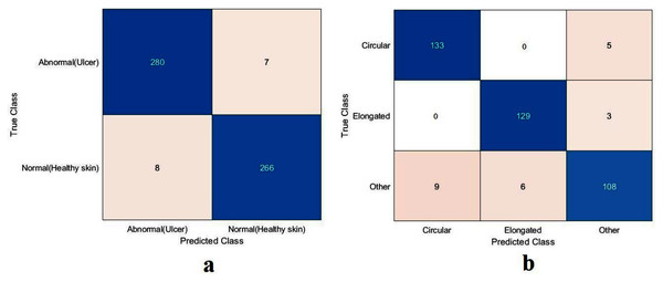 Confusion metrics of the proposed model for (A) DFU and (B) sickle cell anemia.