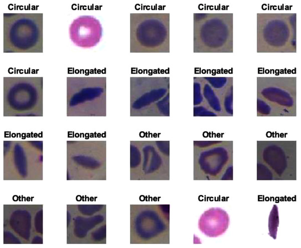 Some of the predictions of erythrocyte samples test set.