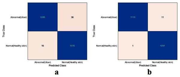 Confusion metrics of the proposed model for (A) training from scratch, (B) training with TL.