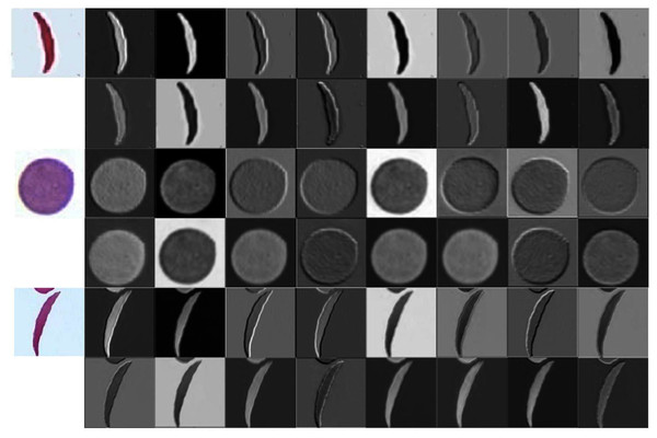 Learned filters from the first convolution layer of the model trained on erythrocyte images.