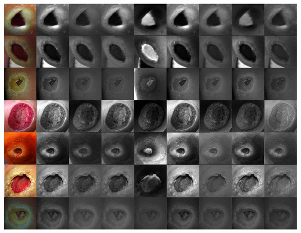 Learned filters from the first convolution layer of the model trained on foot images.