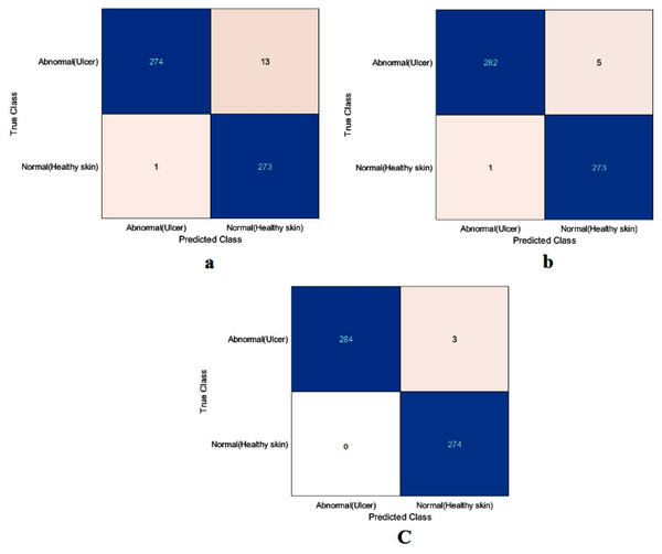 Confusion metrics of the DFU task for (A) the proposed model, (B) Xception, and (C) ResNet50.