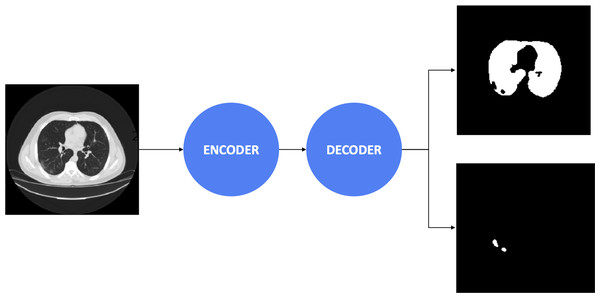 The process diagram of segmentation model.