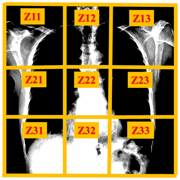 Zones of chest X-ray images for attention visualization.