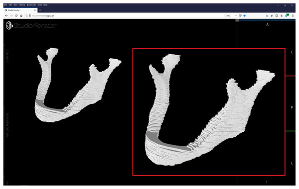 Visualization of a manual segmentation of the lower jawbone.