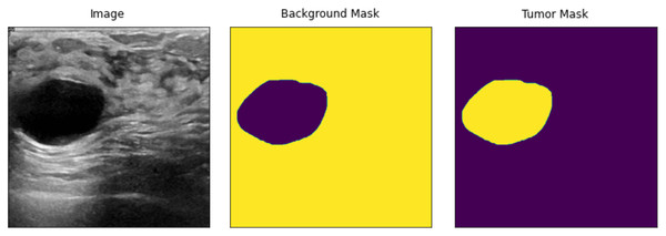 Resized input samples (left) = original Images, (Mid) = background mask and (right) = tumor mask.
