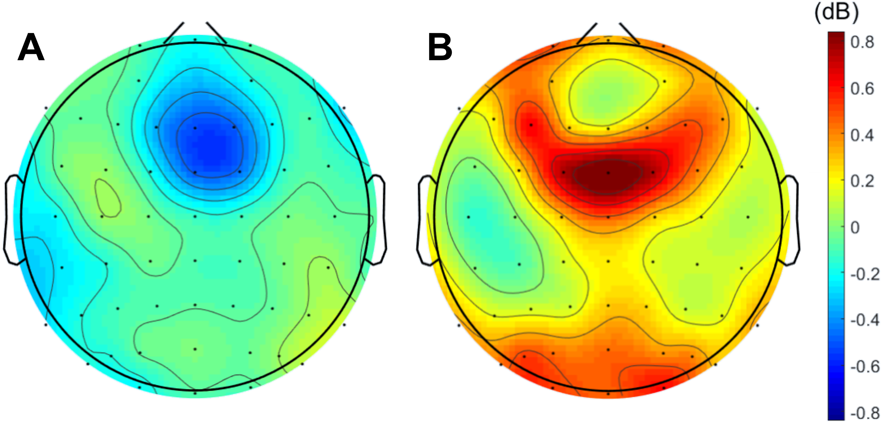 A neuronal theta band signature of error monitoring during integration ...