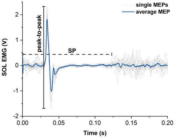 Representative example of motor evoked potentials (MEPs) and silent periods (SPs) from raw soleus (SOL) EMG signals elicited by suprathreshold transcranial magnetic stimulation (TMS).