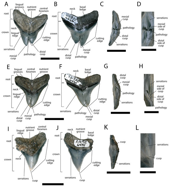 External morphology of Carcharhinus leucas teeth.