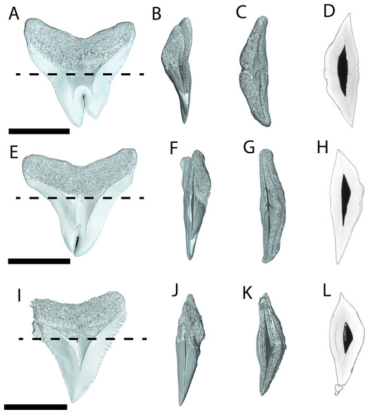 Internal morphology of Carcharhinus leucas teeth.