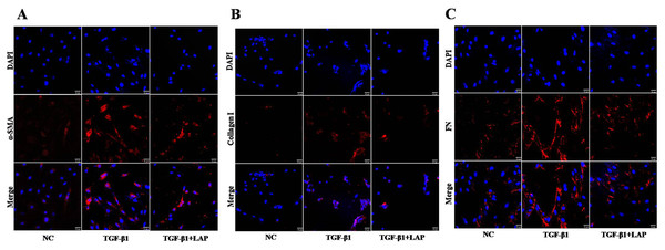 Detection of fibrosis-related proteins expression in H9C2 cells by Immunofluorescence.