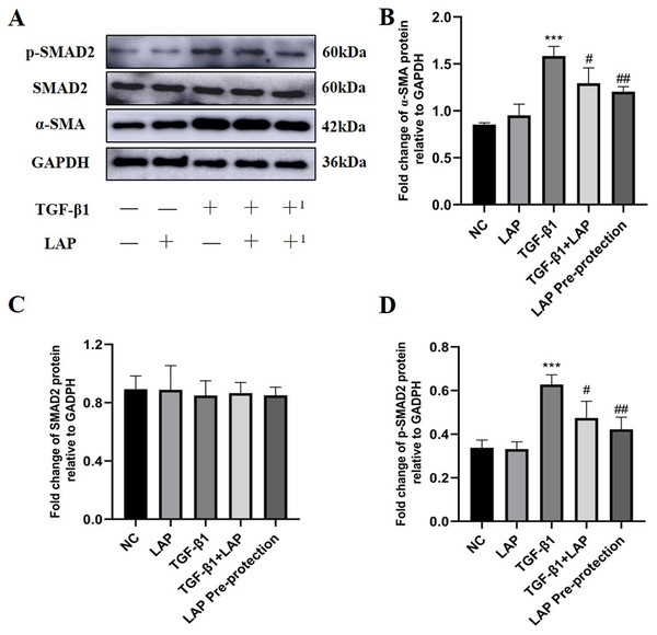 Western blot analysis of the effect of LAP on TGF-β1-induced fibrosis of H9C2 cells through TGF-β/Smad pathway.