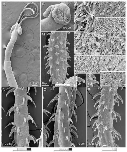 Scanning electron micrographs of Rhinoptericola jensenae (Schaeffner & Beveridge, 2012b) n. comb.