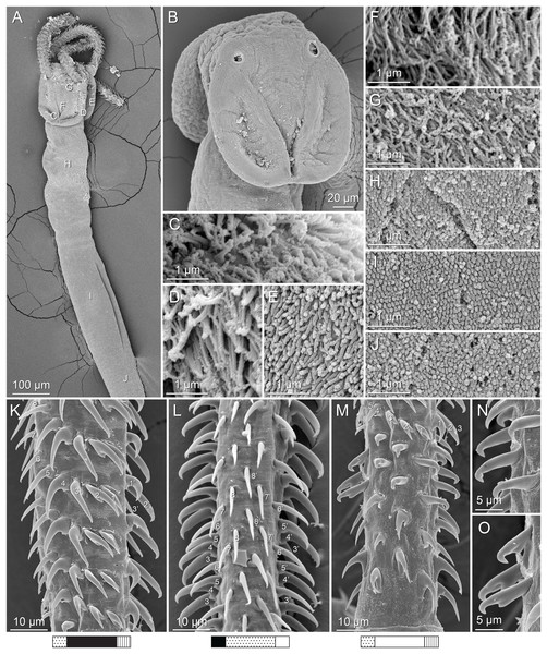 Scanning electron micrographs of Rhinoptericola schaeffneri n. sp.