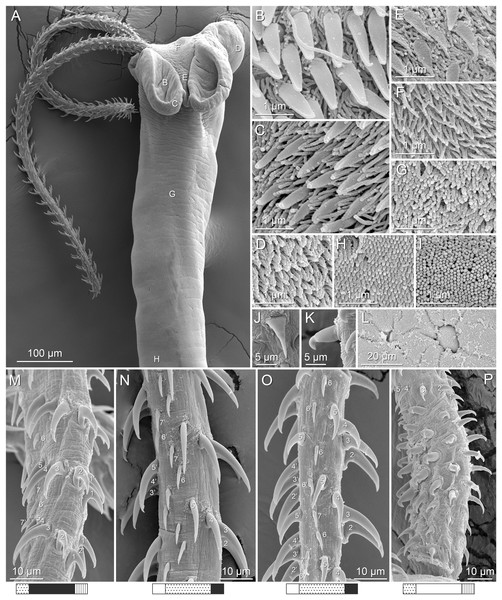 Scanning electron micrographs of Rhinoptericola mozambiquensis n. sp.