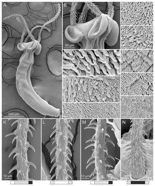 Scanning electron micrographs of Rhinoptericola hexacantha n. sp.