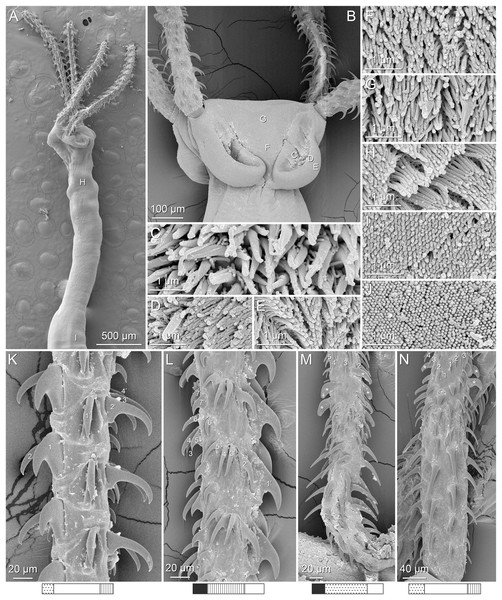 Scanning electron micrographs of Rhinoptericola butlerae (Beveridge & Campbell, 1988) n. comb.