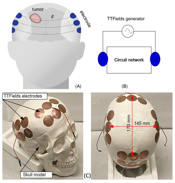 Schematics and photographs TTFields treatment of TTFields electrode arrays.