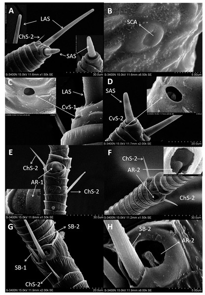 Scanning electron micrographs of various antennal sensilla of Bactericera gobica.