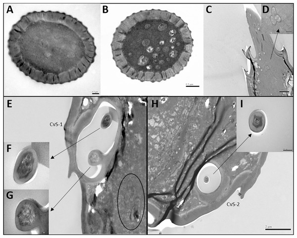 Transmission electron micrographs of various antennal sensilla of Bactericera gobica.