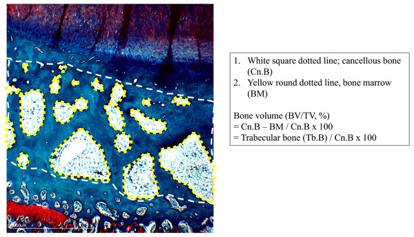 Definition of tissue compartment in subchondral bone.