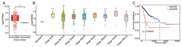 Expression of FSCN1 in clinical samples of cervical cancer in TCGA.