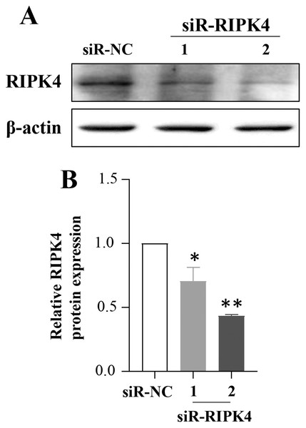 A431 cell line was transfected with RIPK4 siRNA and negative control siRNA.