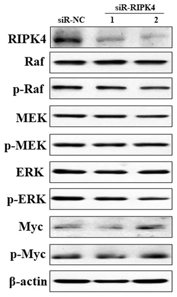 Silencing of RIPK4 did not affect Raf/MEK/ERK pathway.