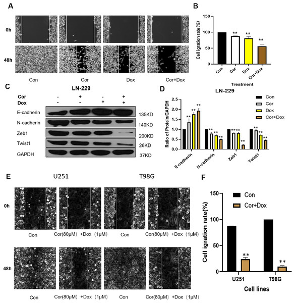 Effect of cordycepin combined with doxorubicin on cell migration.