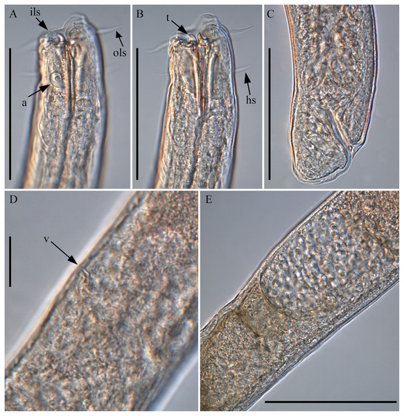 Piipironus grandis gen. et. sp. nov. Female patratype. Light microscopy.