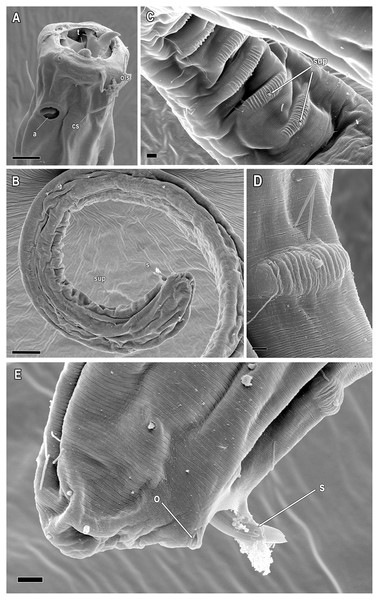 Piipironus grandis gen. et. sp. nov. Male paratype. Scanning electron microscopy.